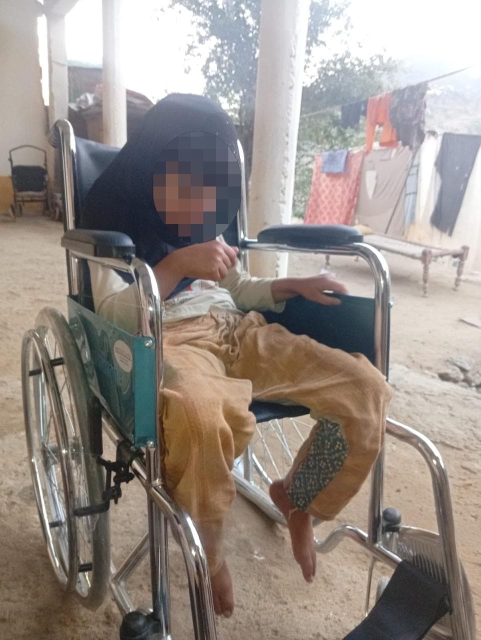 A young woman sits in a new wheelchair in a sunlit courtyard